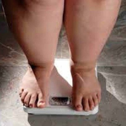 Obesidade demanda avaliação mais apurada