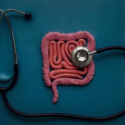 11 hábitos para melhorar o funcionamento do intestino