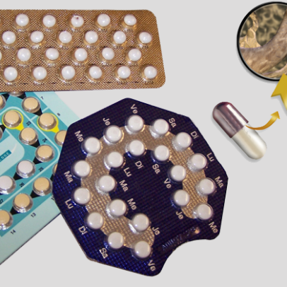 Implantes hormonais manipulados podem representar riscos à mulher