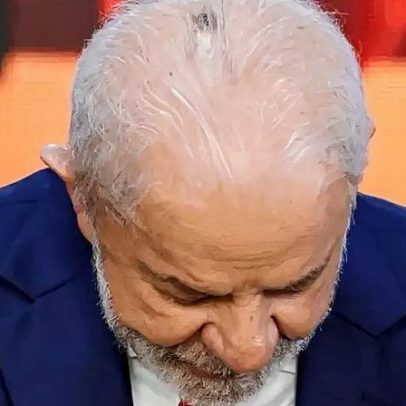 Lula faz primeira sessão de radioterapia; saiba detalhes do procedimento