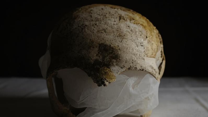 Crânio da Santa Zdislava de Lemberk antes do roubo; relíquia foi encontrada em bloco de concreto