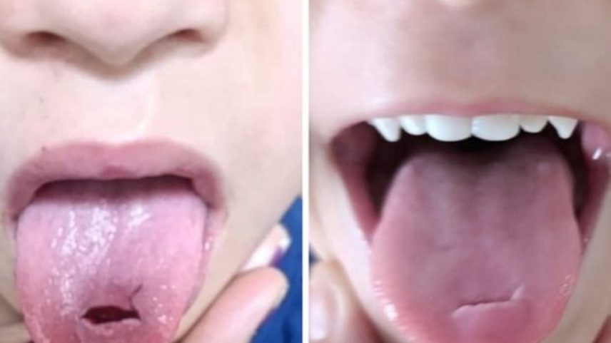 Antes e depois do machucado de Alexandre — Foto: Arquivo pessoal