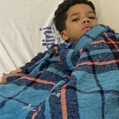 Mãe alerta após filho engasgar com moeda