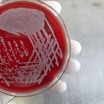 Enzimas que atacam biofilme reduzem resistência bacteriana a antibióticos