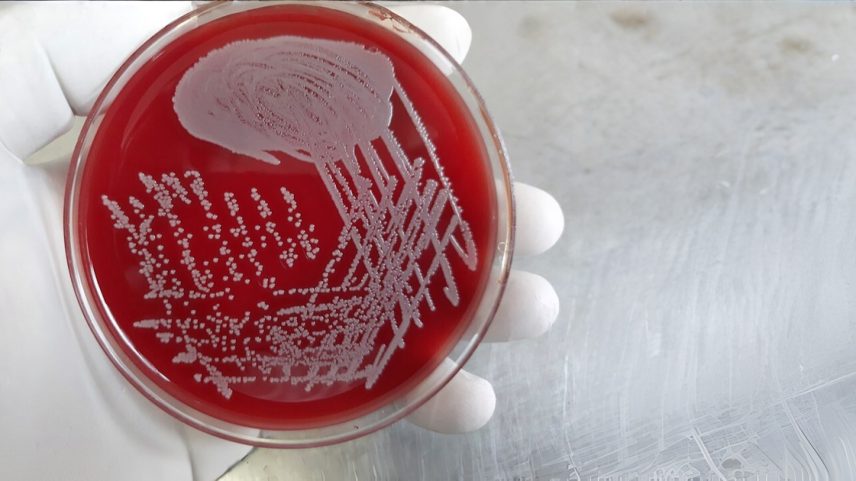 Colônia da bactéria Staphylococcus aureus, em forma de pontos, linhas e manchas brancas, em placa de laboratório contendo ágar, substância avermelhada