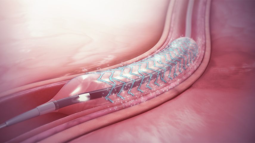 Problemas cardiovasculares são a principal causa de adoecimento e mortalidade em pacientes com diabetes - Foto: Wikimedia Commons