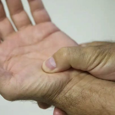 Desafios do projeto de benefícios para pacientes com doenças graves