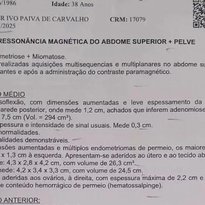 Patricia enfrenta adenomiose e endometriose em busca de saúde