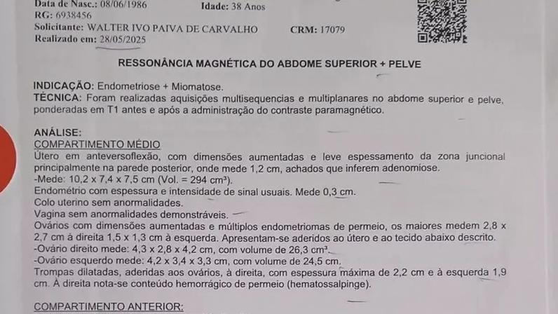 Juntos pela saúde: a luta de Patricia contra a adenomiose e endometriose
