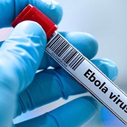 Ebola 2026: sem vacina licenciada, avanços e desafios no tratamento