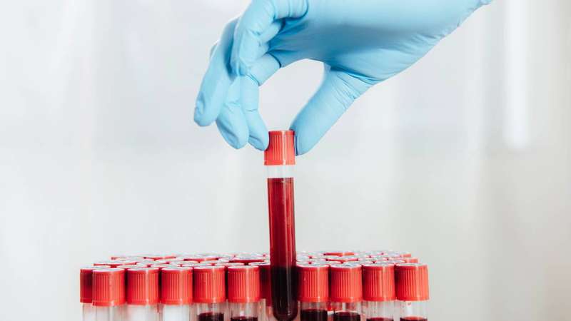 Biomarcadores ligados à inflamação, hormônios do estresse e atividade genética já mostram resultados promissores em estudos recentes – depositphotos.com / MicEnin