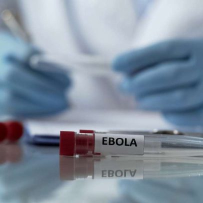 Surto de Ebola: o que se sabe até o momento