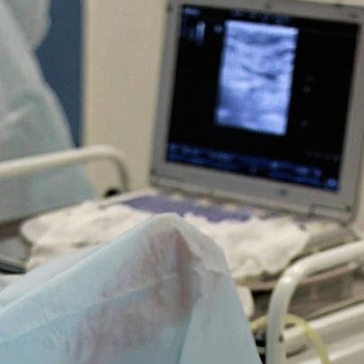 Abortos na Escócia atingem recorde em 2025 com mais de 18 mil casos