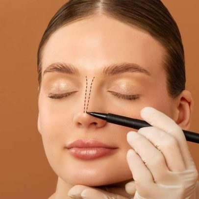 Rinoplastia une estética e função respiratória