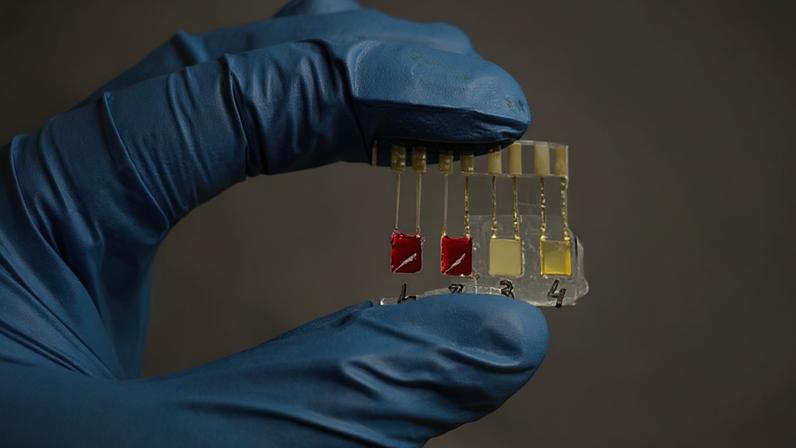 Biossensor desenvolvido no Brasil identifica câncer de pâncreas em estágios iniciais.