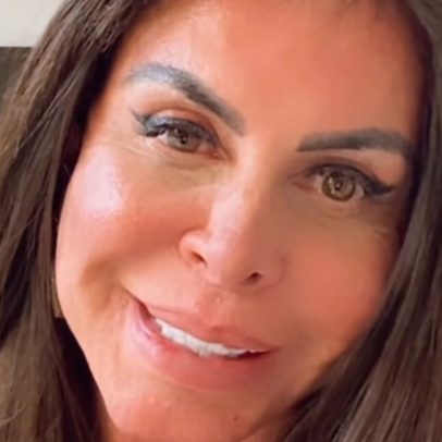 Gretchen fala sobre alopecia progressiva e revela queda de cabelo acentuada