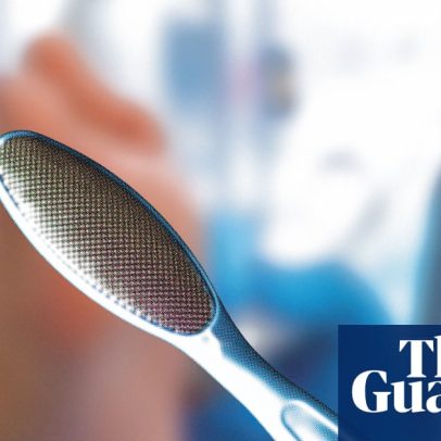 Pedicure médico salvou meus pés do ponto sem retorno