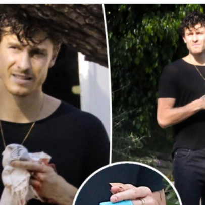 Shawn Mendes explica acidente doméstico que machucou a mão