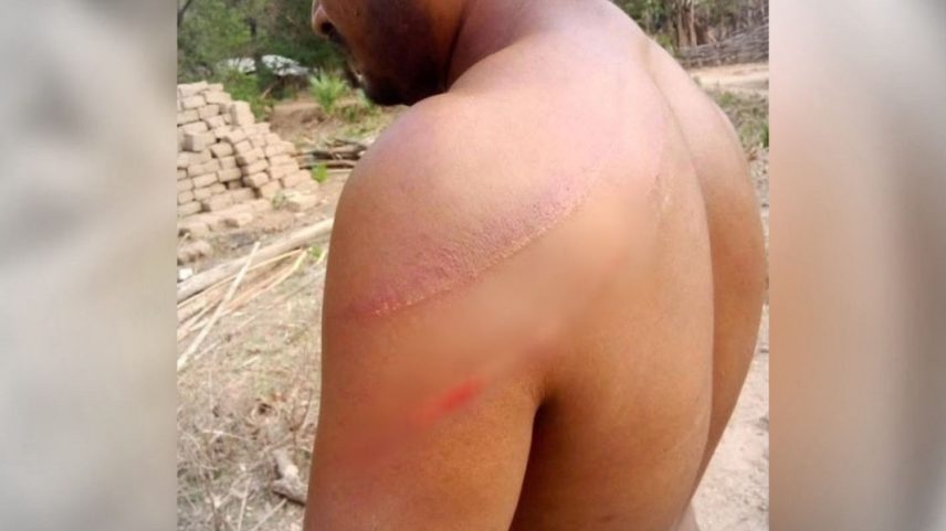 O pastor Motu Sodi após as agressões. (Foto: Reprodução/Morning Star News)