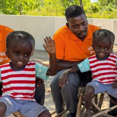 Menino africano com má-formação inspira fé ao afirmar que vai ao Céu