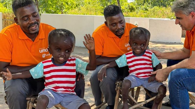 Menino africano com má-formação inspira fé ao afirmar que vai ao Céu