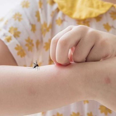 Pediatra mostra como identificar picadas em crianças e o que fazer
