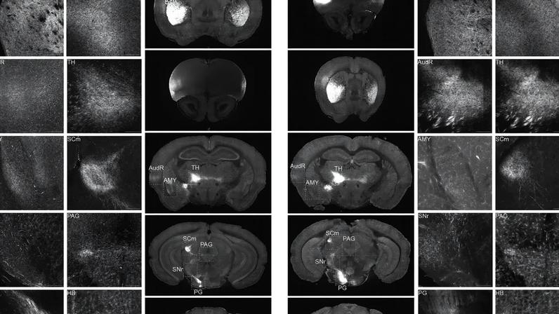 Comparativo de imagens cerebrais de camundongos cantores e de laboratório (Nature/Divulgação)