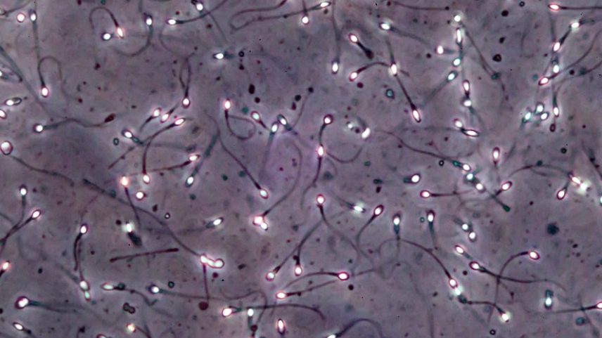 É a primeira vez que se demonstra que um transplante de tecido testicular pré-púbere criopreservado restaura a produção de espermatozoides em um paciente adulto.