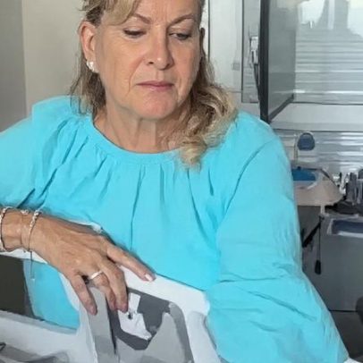 Ex-participante de reality passa por cirurgia cardíaca de 7h com 4 pontes de safena