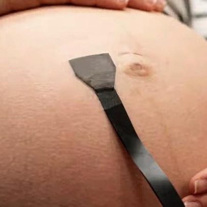 Adesivo ultrassônico monitora bebê no útero de forma contínua