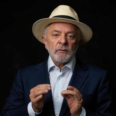Tratamento do câncer de pele no couro cabeludo é discutido no caso de Lula