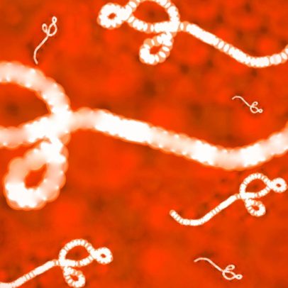 Casos de ebola aumentam em Uganda e OMS declara emergência internacional