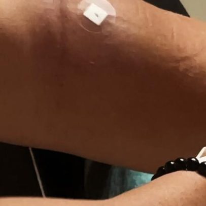 Técnica de enfermagem relata agressão de Magno Malta em hospital; senador nega