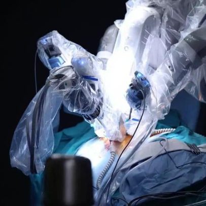 Cirurgia robótica transforma o SUS com tecnologia avançada na saúde pública