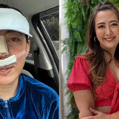 Rinoplastia antiga: como identificar materiais permanentes usados no rosto