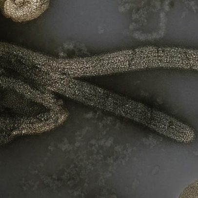 Potencial pandêmico do Ebola difere do Covid-19, afirma infectologista