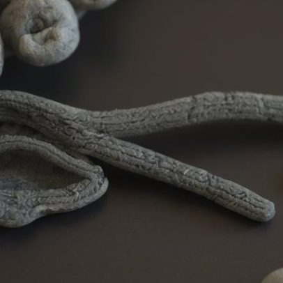 Risco de Ebola chegar ao Brasil é explicado por especialista
