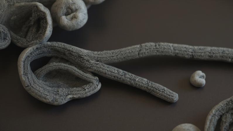 Imagem microscópica eletrônica do vírus Ebola