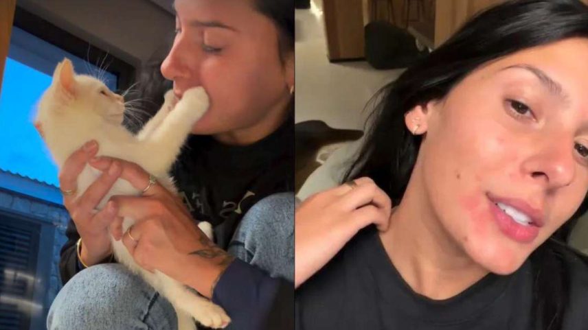 Alergia a pets após caso de Ana Castela levanta alerta