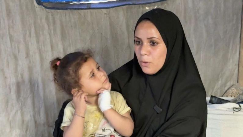 Samah, a small child sits on her mother's lap. One of her hands is covered by a bandage because she was bitten by a weasel at night, her mother says.