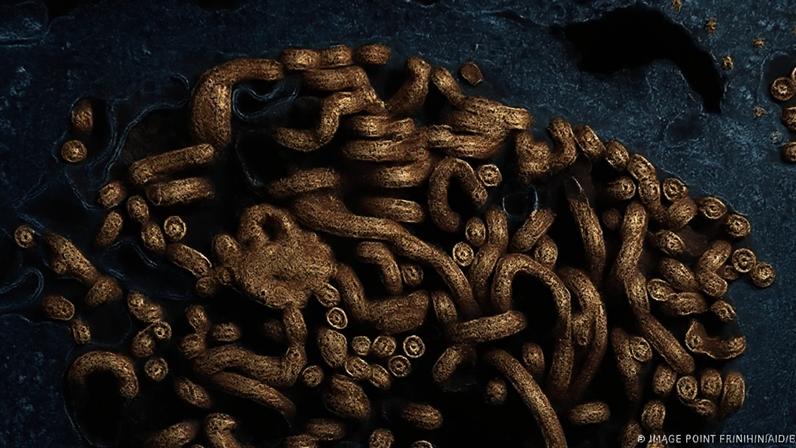 O Ebola, que se acredita ter se originado em morcegos, pode causar sangramento grave e falência de órgãos