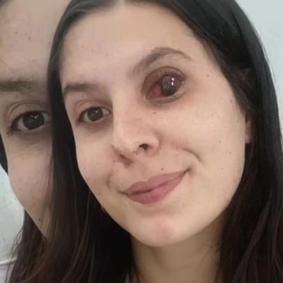 Esther enfrenta câncer e precisa de apoio para salvar visão e vida