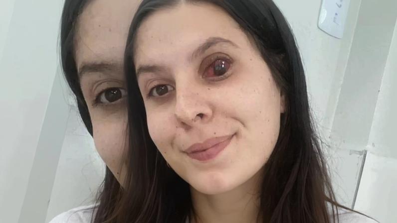 Esther luta contra o câncer: ajude a salvar sua visão e sua vida!