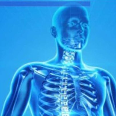 Alimentos ricos em ferro ajudam a prevenir anemia