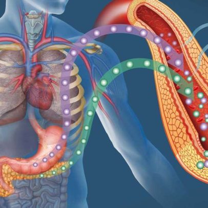 Pâncreas artificial marca nova era no tratamento do diabetes