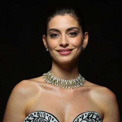 Anne Hathaway ficou quase cega por 10 anos até cirurgia que restaurou a visão