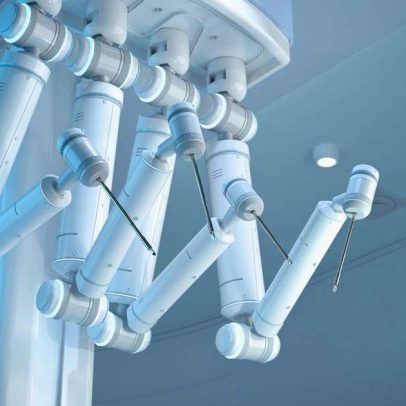 Cirurgia robótica de alta precisão chega ao SUS, reduz internação