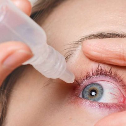 Rosácea ocular avança com nova tecnologia de tratamento