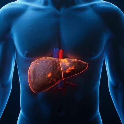 Hepatologista alerta: suplementos podem prejudicar o fígado