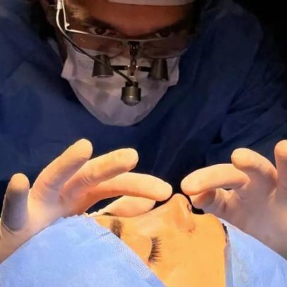 Rinoplastia ultrassônica avança em cirurgias nasais